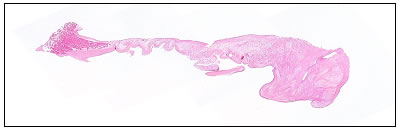 Abnormal dog mitral valve